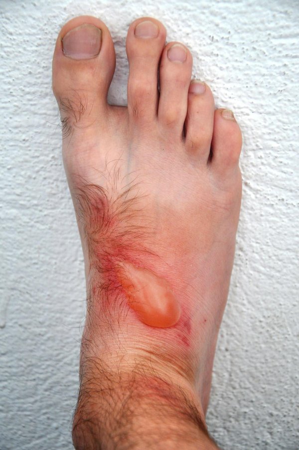 ¿Cómo tratar la dermatitis en perros de forma natural?